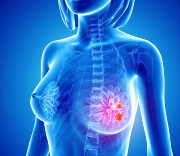 prevent cancer