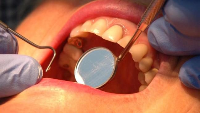 Dental health Crisis for Children